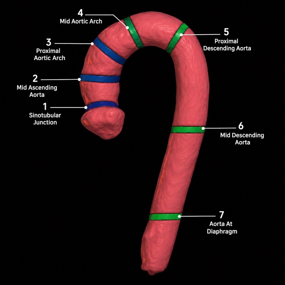 3D reconstruction of the thoracic aorta with standard measurement points