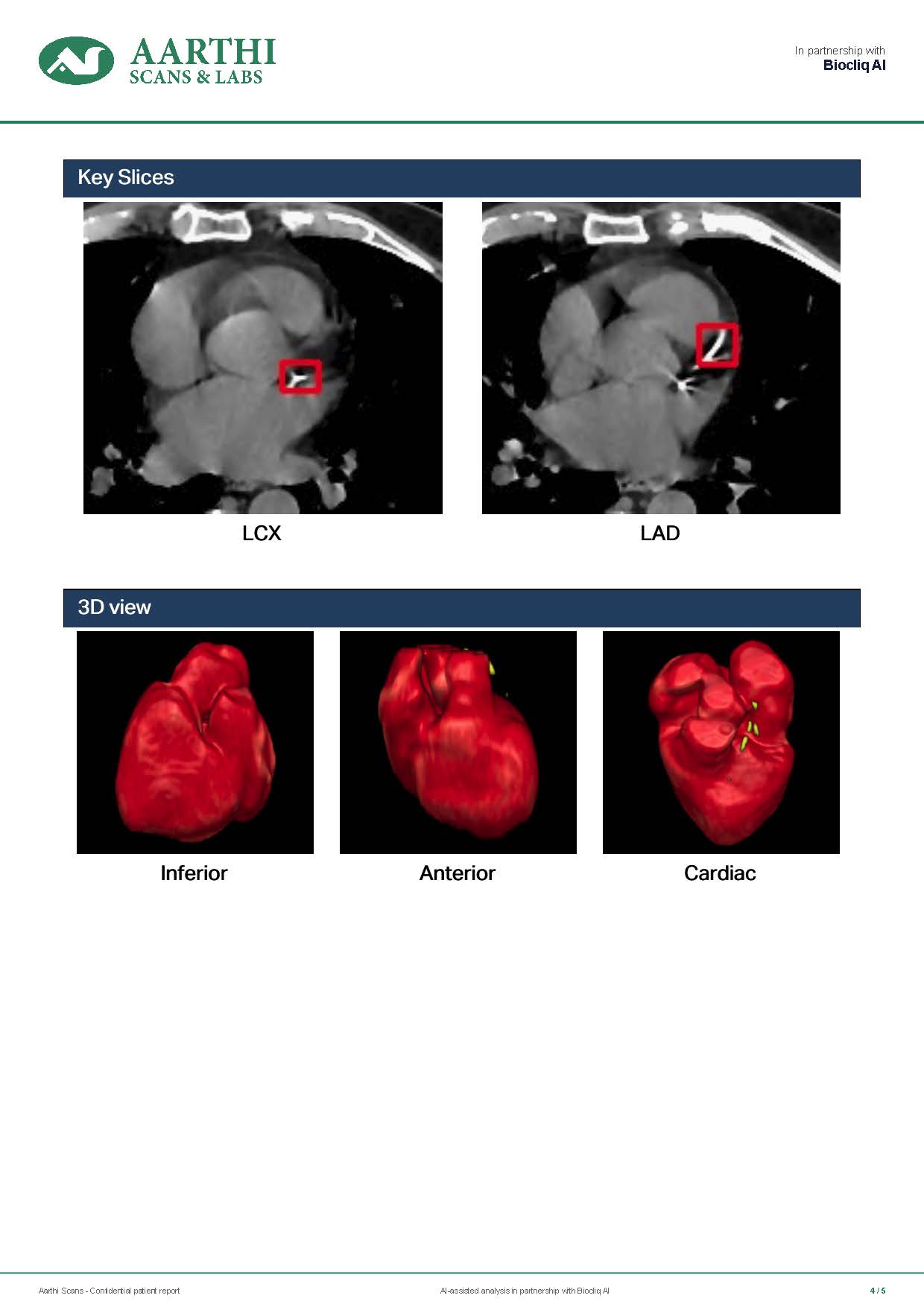 Page 4 of the anonymised sample Heart Health Report with key scan images