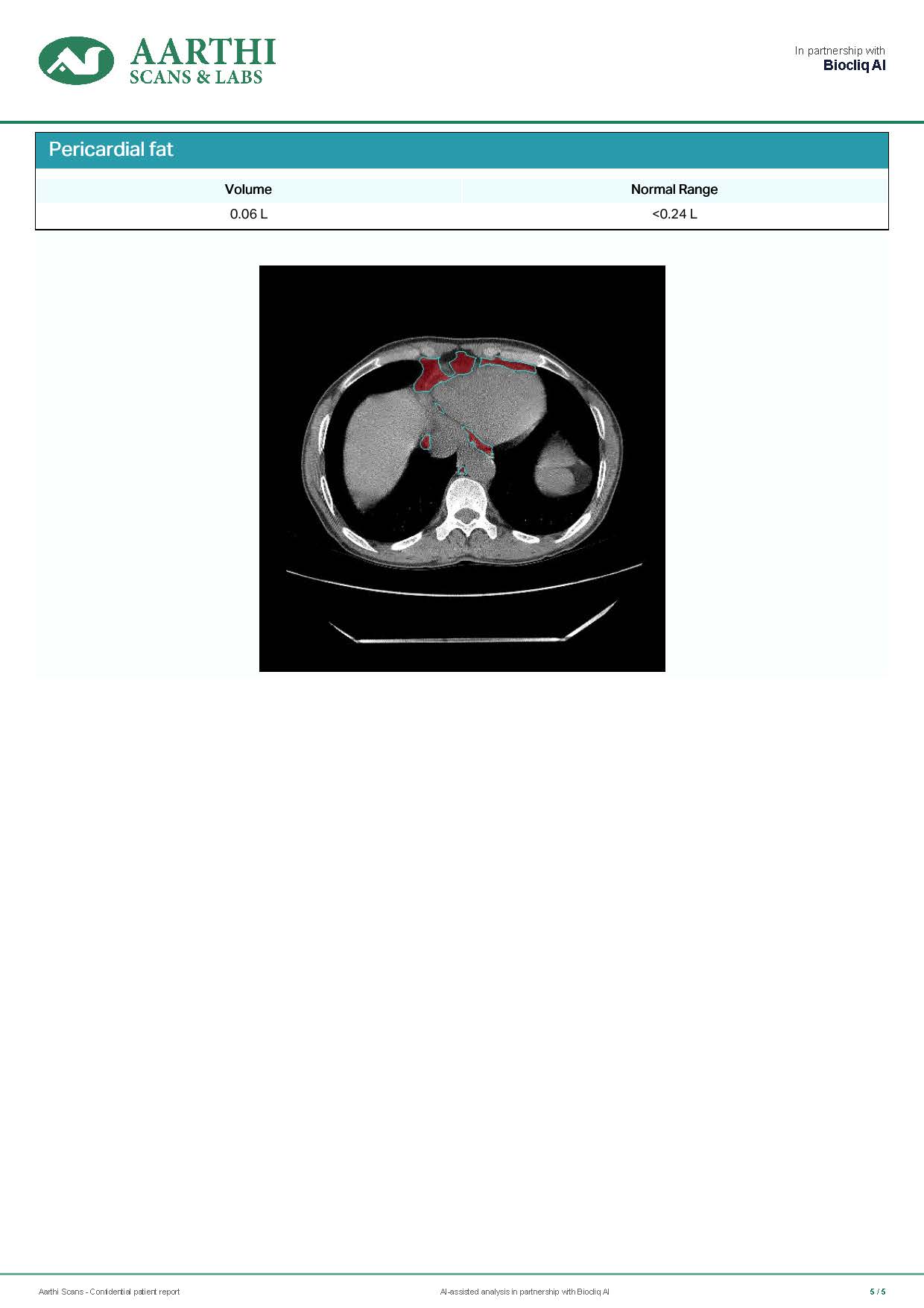 Page 5 of the anonymised sample Heart Health Report with pericardial fat findings